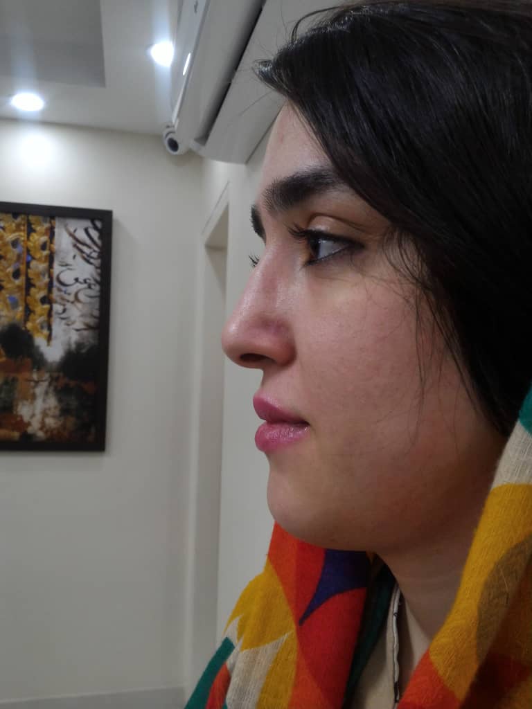 نخ بینی